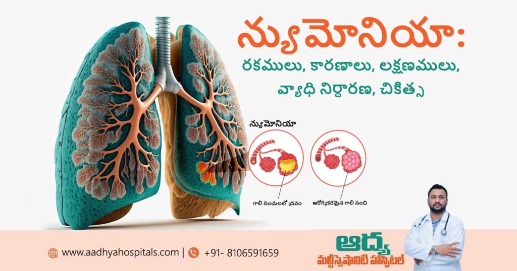 pneumonia-symptoms-causes-treatment